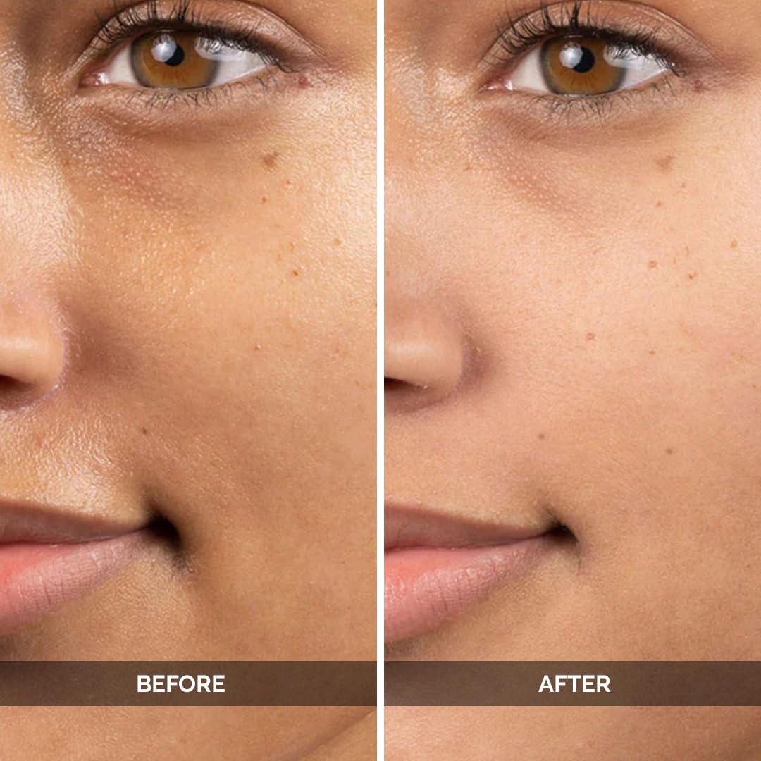 LuxaDerme Korean Ultra Brightening Face Serum, Brightens Skin and Reduces Dark Spots, Daily Use for Brightening & Even Skin Tone | 91% Natural Ingredients with Yuzu, Glutathione & Astaxanthin | 30ml