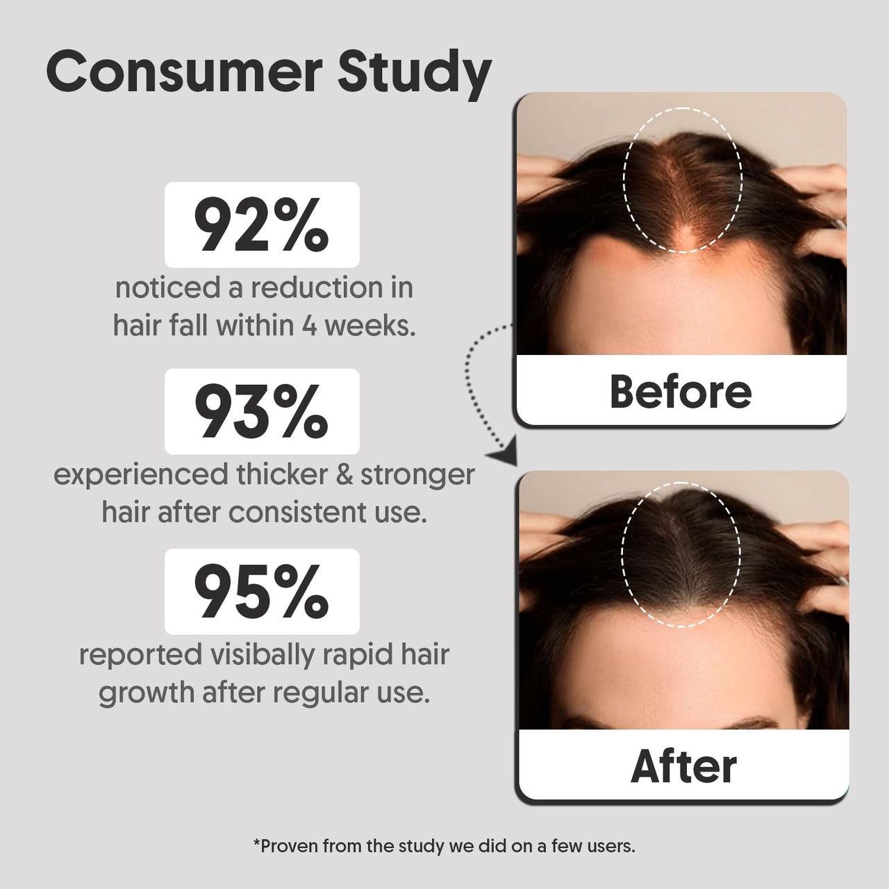 Aravi Organic Hair Growth Serum With 3% Redensyl, 2% Anagain, 2% Procapil - For Hair Growth And Hair Fall Control - For Men & Women - 30 ml