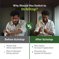 Itchstop® Anti-Fungal Spray | Hands Free | Instant Relief from Itching, Ringworm, Eczema, Redness, Chafing, Jock Itch, Athlete's Foot | Ayurvedic, Safe for Men & Women, Daily Use, 35ml - Pack of 2