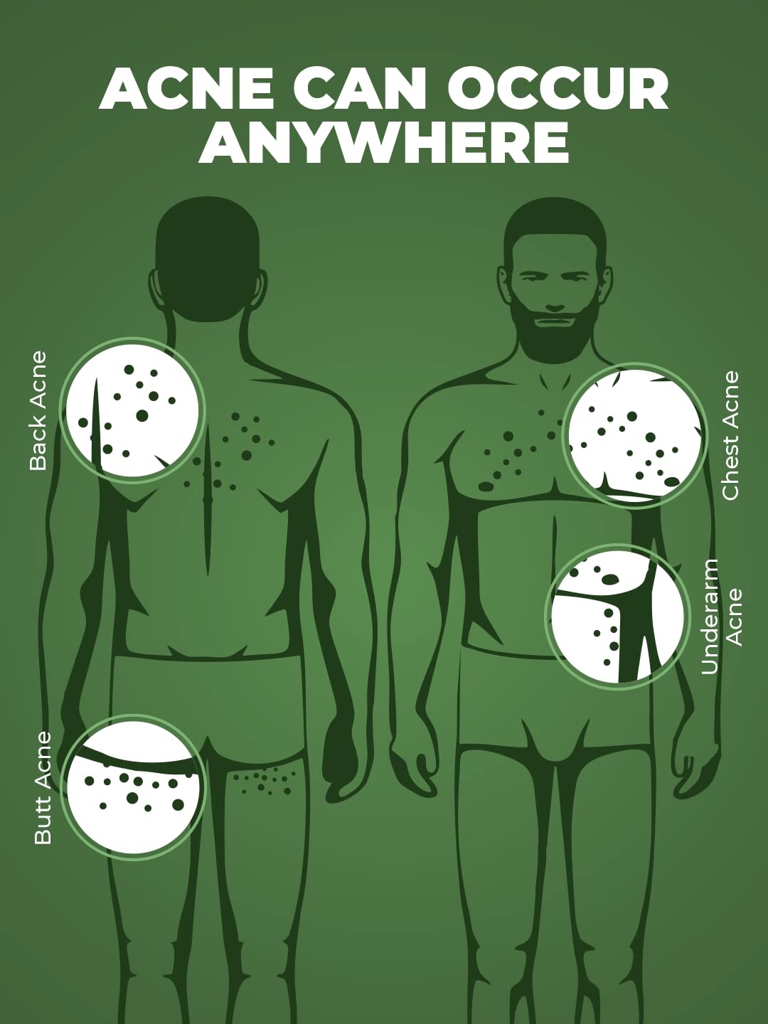 Beardo Body Acne Clear Body Wash for Men 200 ml | With Neem, Tea Tree and Salicylic Acid | Clean Clear Skin | For Body Acne and Skin Purification | B-acne