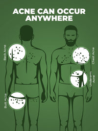 Beardo Body Acne Clear Body Wash for Men 200 ml | With Neem, Tea Tree and Salicylic Acid | Clean Clear Skin | For Body Acne and Skin Purification | B-acne