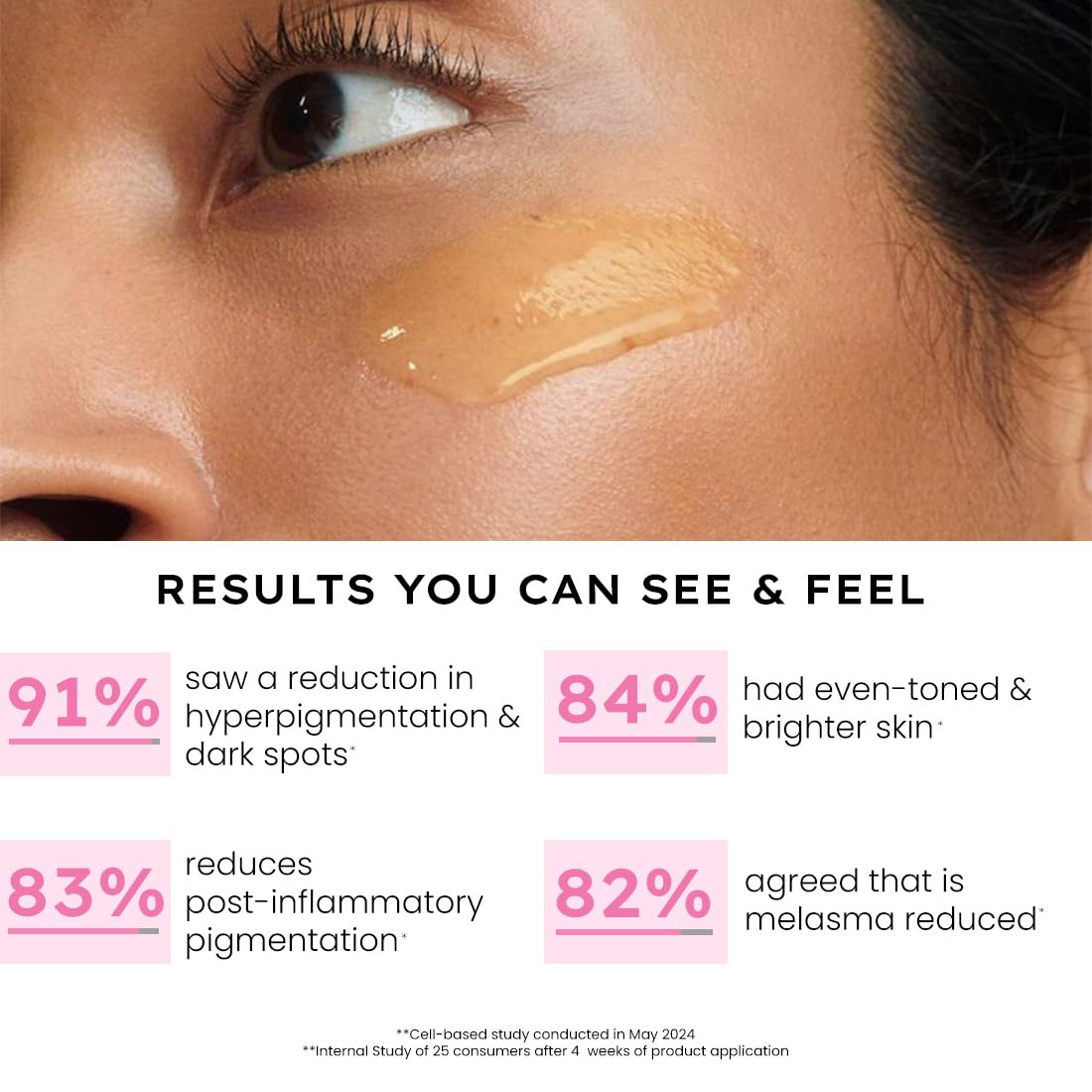 Hyphen Advanced De-Pigmentation Serum For Hyperpigmentation, Melasma, Dark Spots & Scars With 2% Kojic Acid | Visibly Brightens & Even Tones Skin | Serum For Women & Men - 30ml