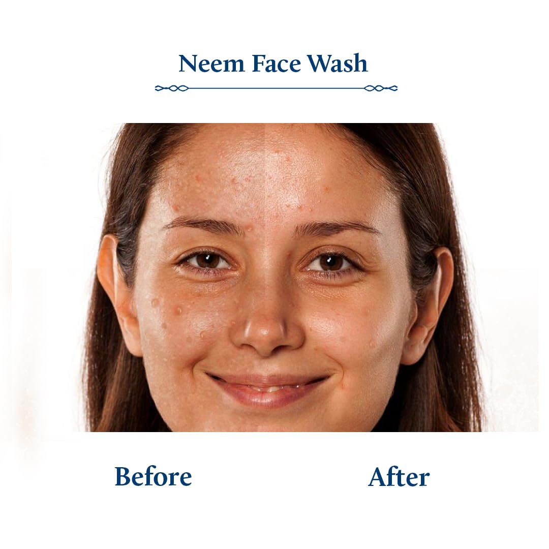 Blue Nectar Plant Based Vitamin C Face Wash for Women and Men Face Wash for Acne Pimple with Neem Honey Natural Cleanser for Face with Ayurved