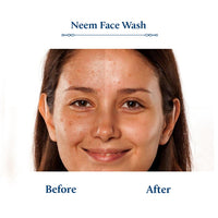 Blue Nectar Plant Based Vitamin C Face Wash for Women and Men Face Wash for Acne Pimple with Neem Honey Natural Cleanser for Face with Ayurved