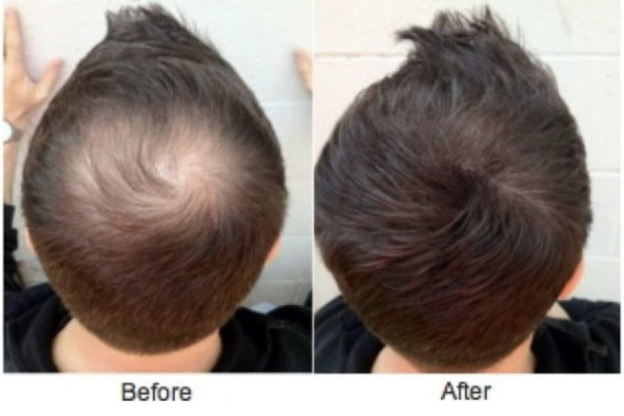 Shills Professional Black Hair Building Fibers Men,Women fibers for Hair loss coverage (net 25g)