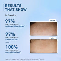 Plum 10% Niacinamide Serum with Rice Water | Provides Clear, Glowing & Brightening Skin | for Acne Prone, Combination, Oily & Sensitive Skin | Oil Control & Anti Acne Face Serum for Women & Men | 15ml