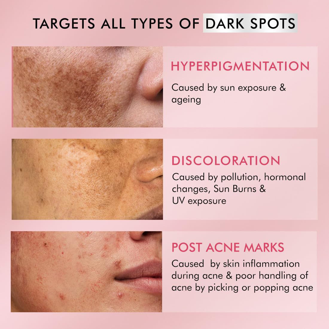 mCaffeine 2% Kojic Acid & 1% Niacinamide De-Pigmentation Cream| Reduces Dark Spots, Melasma, Tan & Evens skin tone |Skin Brightening Lightweight Moisturizer For Men & Women | For All Skin Types- 50g