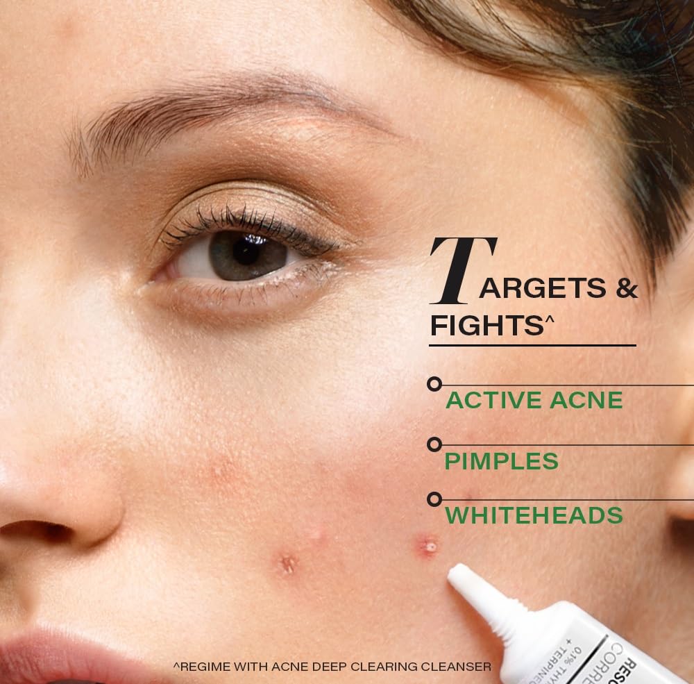 Novology Acne Spot Corrector Gel | For Active Acne, Pimples, Whiteheads | 30g