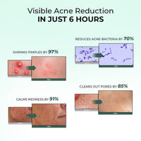 Conscious Chemist® Rapid Relief Acne Spot Corrector Gel | 15g | Triple-Action Treatment with 2% Salicylic Acid & Azelaic Acid | Clears Pimples, Reduces Redness & Fades Dark Spots | For Men & Women