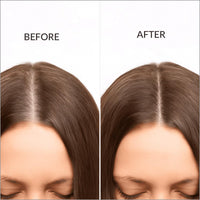 Beauty Garage ScalpSense Hairfall Defense Shampoo 200ml