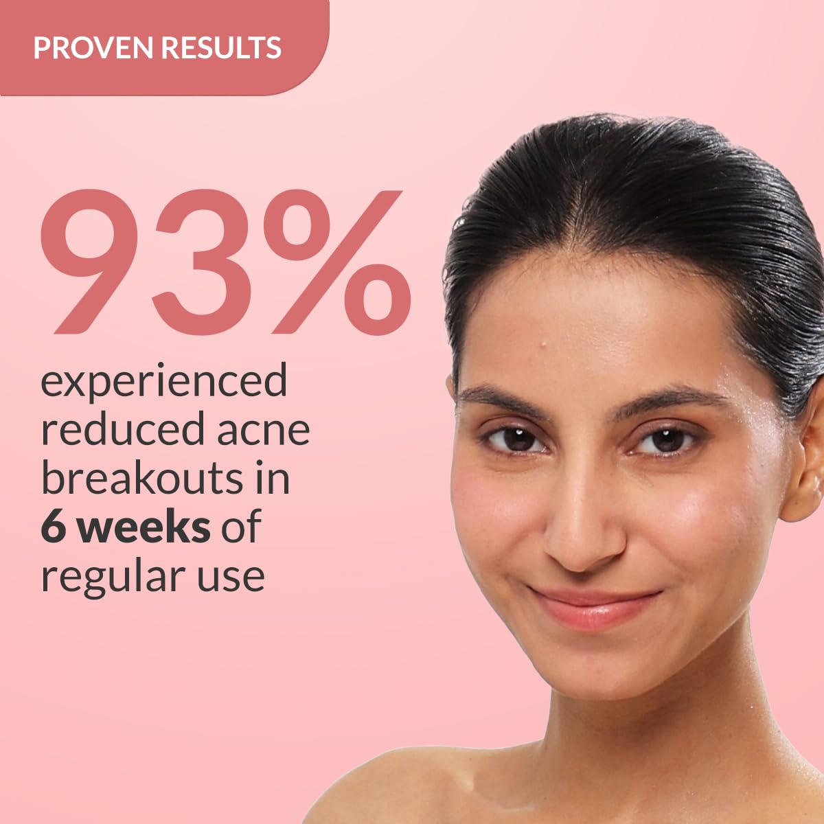 Fixderma 2% Salicylic Acid Serum for Anti Acne & Spot Treatment with 5% Azelaic Acid & 4% Mandelic Acid | Anti Acne Face Serum | Face Serum for Men & Women - 30g…