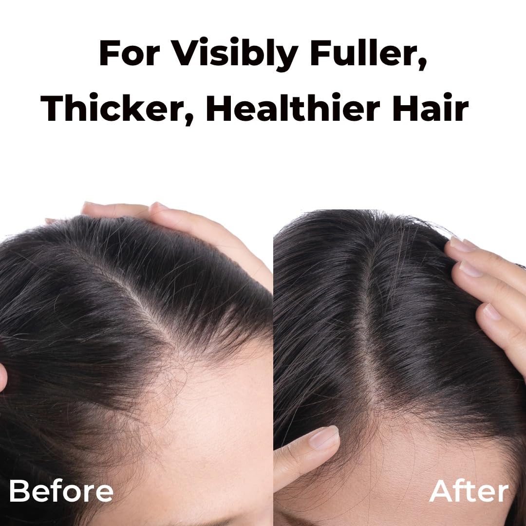 Brillare Professional Hair Fall Control Shampoo, Natural Anti Hair Fall & Hair Growth Shampoo with Soyabean & Vital Plant Extracts for Better Hair Holding, 300 ml