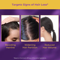 WOW Skin Science Rosemary Pro Hair Growth Serum| Stimulates Hair Growth| Strengthens Roots | Adds Volume | Gives Fuller Looking Scalp| Powered By Rosemary, Redensyl, Anagain, Biotin & Baicapil | 30ml