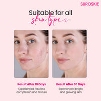 Suroskie Rosanna Rose Instant Glow Face Mask 50Ml | With Rose & Aloe Vera | For Cleans Pores & Dark Spot | Spa Glow At Home | Facial In A Jar | Korean Face Mask For Glowing Skin |Men & Women