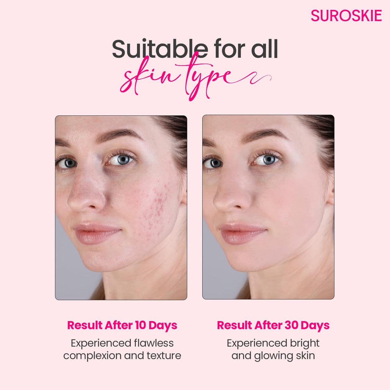 Suroskie Rose Instant Enzyme Face Scrub 50Ml | India’S First Enzyme Scrub For Glowing Skin, Cleans Pores & Dark Spots | Clear White & Black Head | Rose, Aha+ Bha & Cellulose Extract| For Men & Women