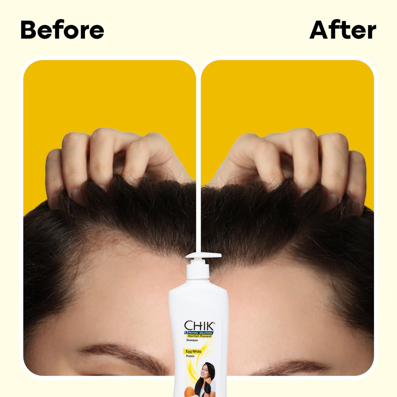 Chik Protein Solution Hairfall Prevent Shampoo, With Goodness Of Egg White, For Thick And Healthier Hair (340ml)