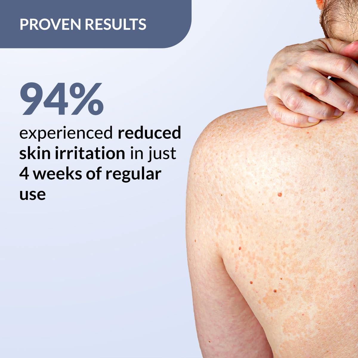 Fixderma Salyzap Body Spray- 100ml