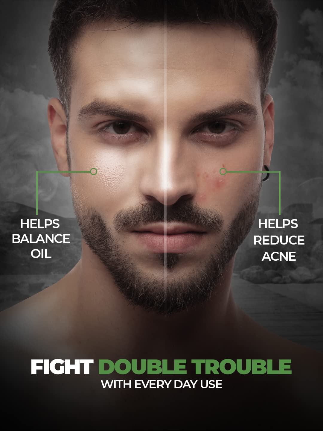 Beardo 2-in-1 Anti Acne Serum + Toner For Men, 30ml | Face Serum For Men | Acne Serum with AHA & Niacinamide | Reduces Pores & Acne Scars for Smooth Skin