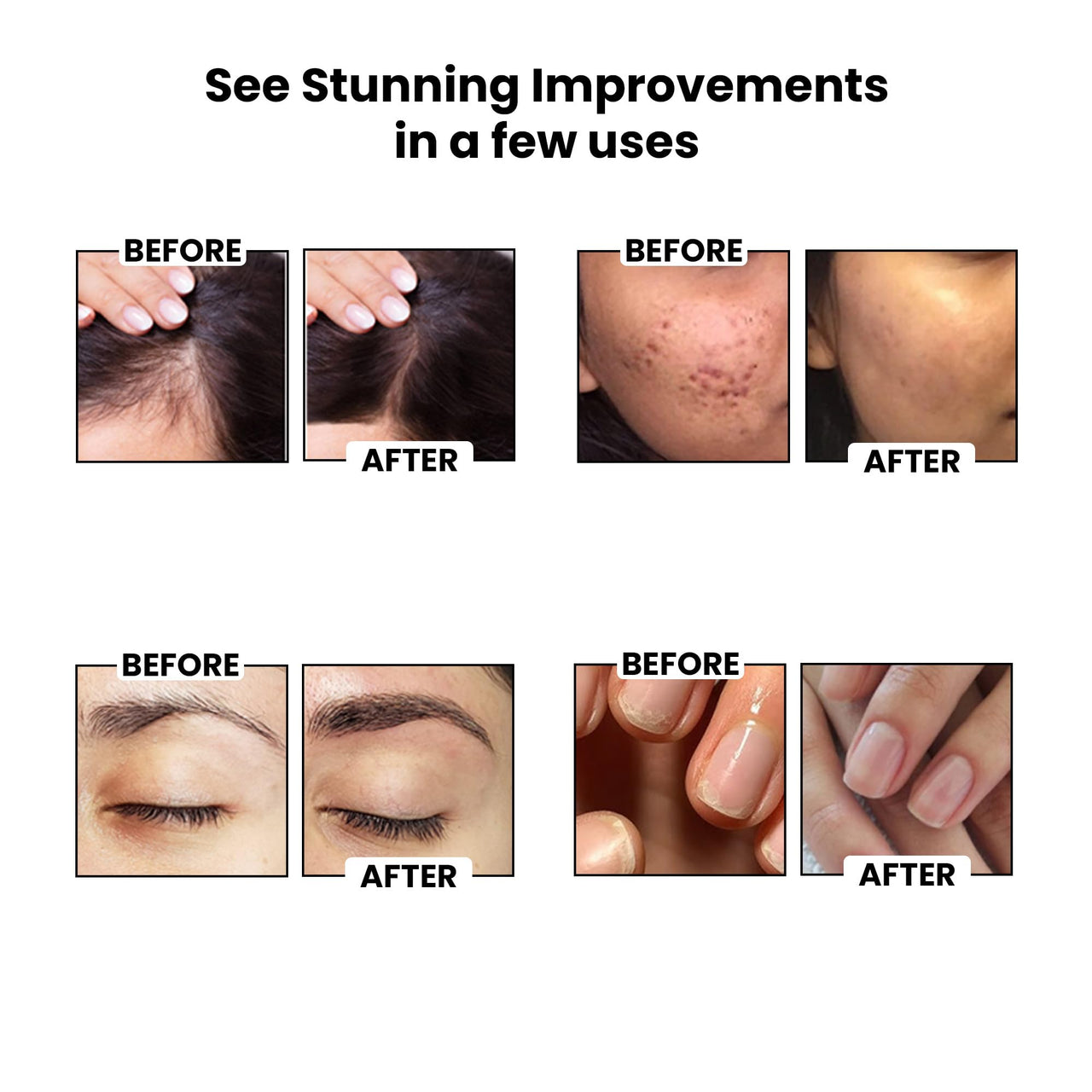 ThriveCo Cold-Pressed Jamaican Black Castor Oil for Hair, Skin, Eyebrows, Eyelashes & Nails | Promotes Scalp Health, Thicker Brows & Lashes | Prevents Hair Breakage | For Men & Women | 50 ml