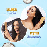 Parachute Advansed Gold Vitamin E Coconut Hair Oil| Long & Soft Hair | For All Hair Type| No Paraben & Silicones| 300ml