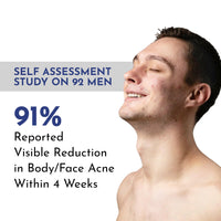 Mannlich Anti-Acne Soap | Controls Excess Sebum | Handmade Body & Face Soap for Acne-Prone and Oily Skin | 2% Salicylic Acid, 2% Niacinamide & 2% Tea Tree Oil | Brightens Skin, Fades Dark Spots | Prevents Body Acne | pH Balanced, SLS Free, Dermatologicall