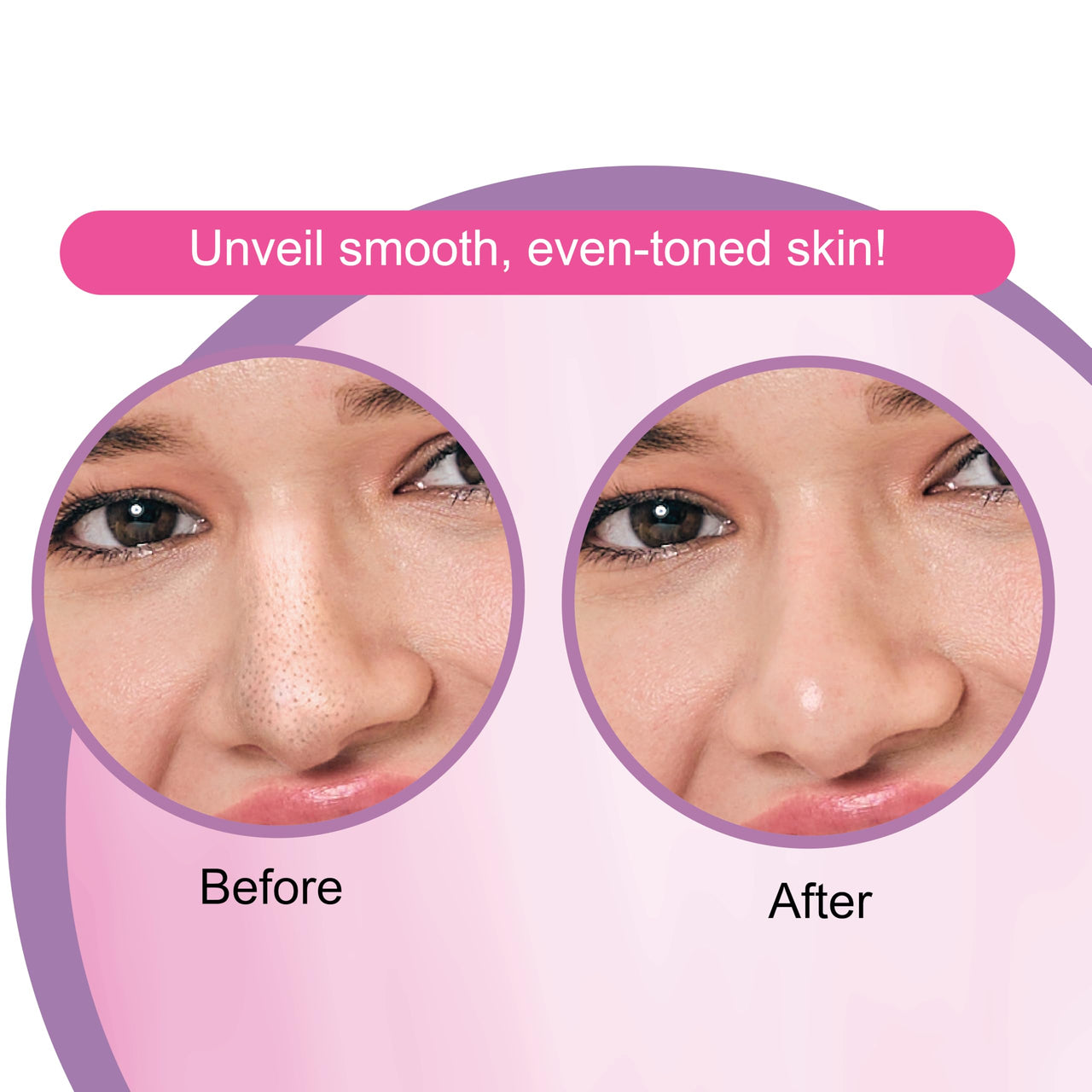 DR.Rashel Nose Pore Strips For Pore Cleansing | Deep Cleansing Nose Strips For Instant And Painless Blackheads Removal || 20 PCS (White Skin) (10 Strips & 10 Wipes)