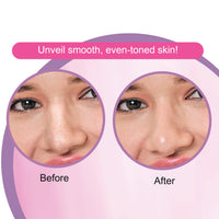 DR.Rashel Nose Pore Strips For Pore Cleansing | Deep Cleansing Nose Strips For Instant And Painless Blackheads Removal || 20 PCS (White Skin) (10 Strips & 10 Wipes)