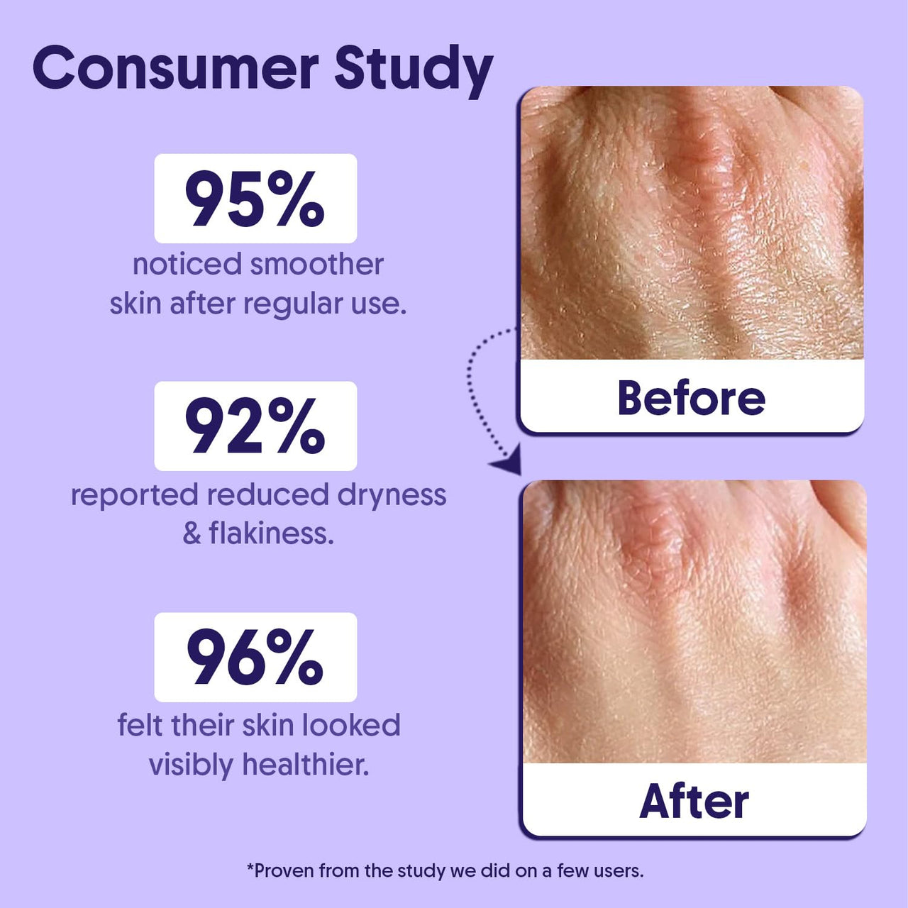 Aravi Organic De-Tan Body Lotion Combo | AHA BHA Body Lotion for Skin Renewal & SPF 50 PA++++ Sunscreen for Tan Protection | Hydrating & Brightening Formula | For Men & Women | 200ml