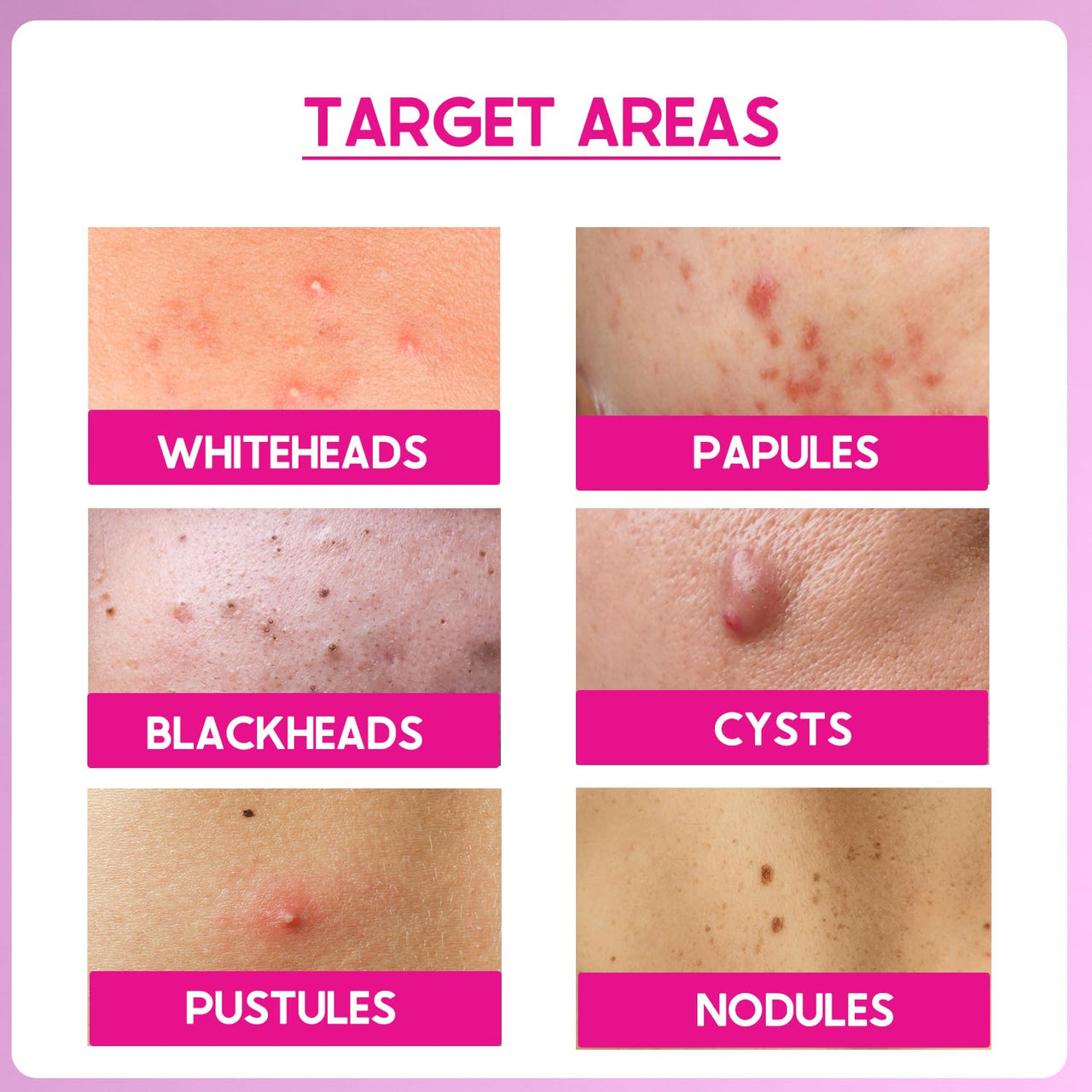 Cos-IQ 25% AHA + 2% BHA + 6% PHA Peeling Solution for Face | 10-Minute Facial | Chemical peel for face for glowing skin | Exfoliating serum| Men & Women | At-home facial | 30ml