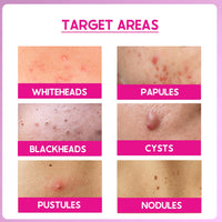 Cos-IQ 25% AHA + 2% BHA + 6% PHA Peeling Solution for Face | 10-Minute Facial | Chemical peel for face for glowing skin | Exfoliating serum| Men & Women | At-home facial | 30ml