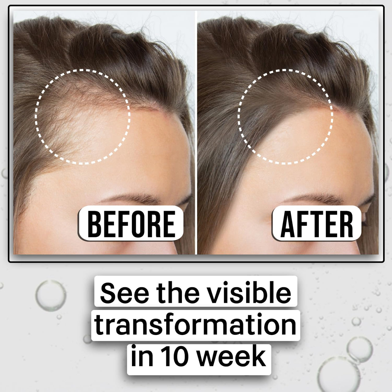 KAZIMA Advanced Hair Growth Serum | 3% Redensyl, 4% Anagain, 2% Procapil, 2% Lindera Strychnifolia, Rosemary & Black Rice Extract | Hair Growth & Hair Fall Control Serum | Boosts Hair Density | 30 ml