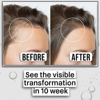 KAZIMA Advanced Hair Growth Serum | 3% Redensyl, 4% Anagain, 2% Procapil, 2% Lindera Strychnifolia, Rosemary & Black Rice Extract | Hair Growth & Hair Fall Control Serum | Boosts Hair Density | 30 ml