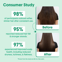 Aravi Organic Anti-Hairfall & Hair Growth Solution | Rosemary Shampoo & Conditioner Combo | Sulphate-Free Formula with DHT Blocker for Stronger, Healthier| For Men & Women | 200ml Each