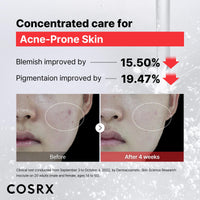 COSRX Niacinamide 15% Face Serum 20Ml, Minimizing Pores & Sebums, Blemish Treatments For Discoloration, Dark Spots, Enlarged Pores, Artificial Fragrance & Parabens-Free