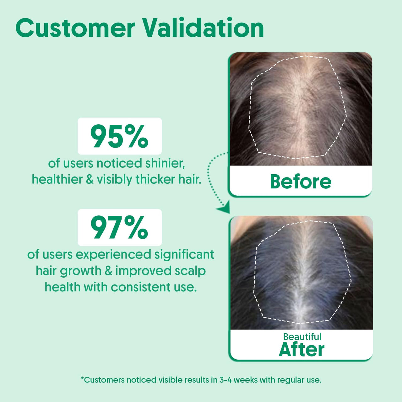 Aravi Organic Rosemary Essential Oil for Hair Growth,Quick Hair Growth Rosemary Oil for Women and Men - 100% Pure Rosemary Leaves Oil - 100 ml