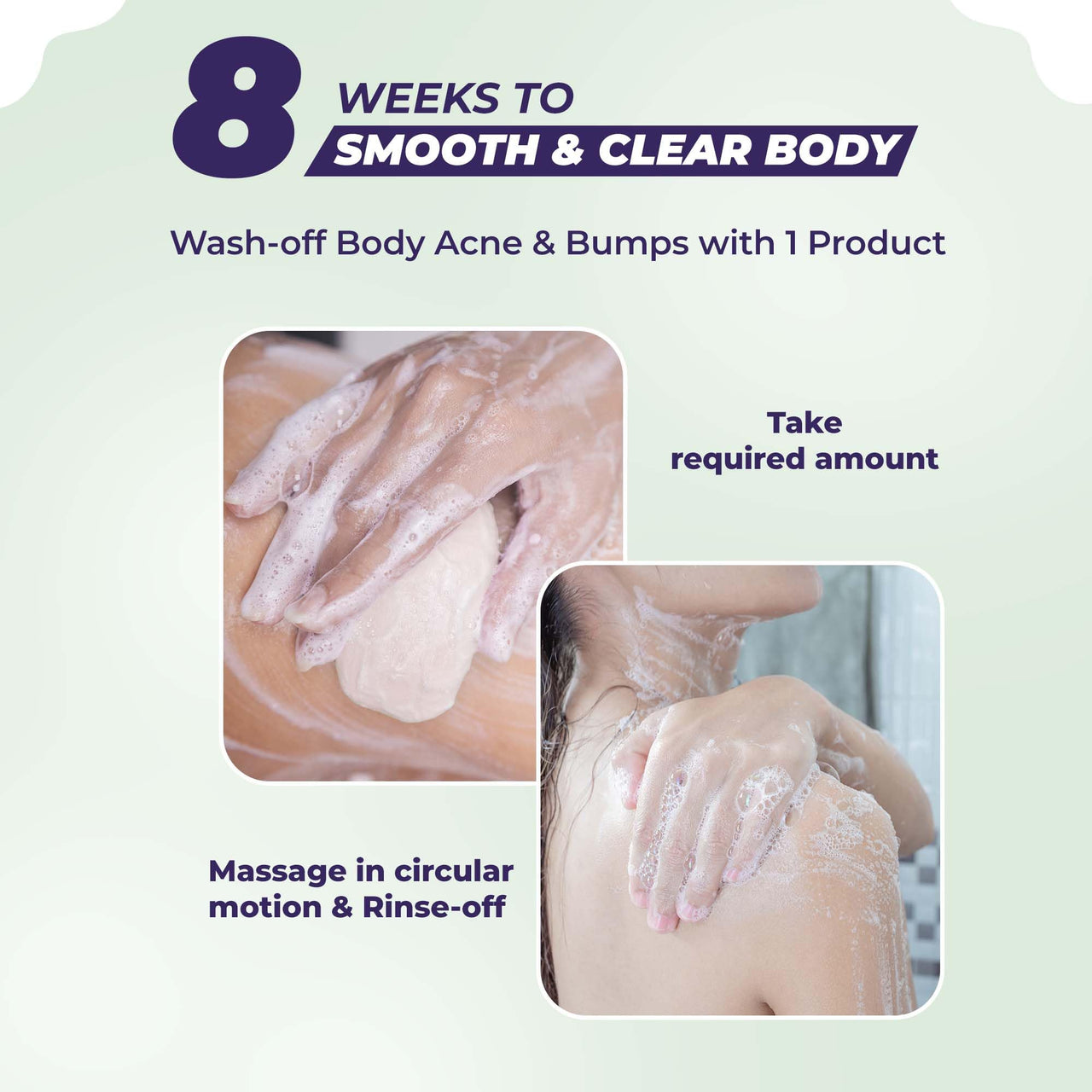 Sanfe Dark Spots & Acne Clearing Body Soap | Prevents Body Acne, Bumpy Skin & Fades Dark Spots | Salicylic Acid 2% W/W, Benzoyl Peroxide | Non Drying Formula (Pack of 1)