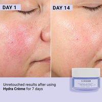 SEREKO Hydra Creme Ceramide Moisturizer, Skin Barrier Repair Cream, Long Lasting Hydration Up To 100 Hours, Locks Moisture, With Peptide, Lightweight Gel Formula, All Skin Types, For Men & Women, 50ml