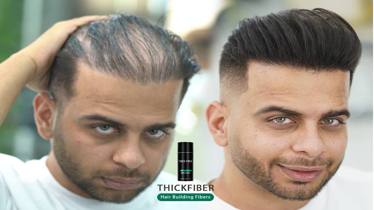 Thick Fiber - Hair Building Fibers (Black)- Hair Fibers For Thin & Fine Hair -Hair Thickening Fibers for Men & Women (25 g (Pack of 1))