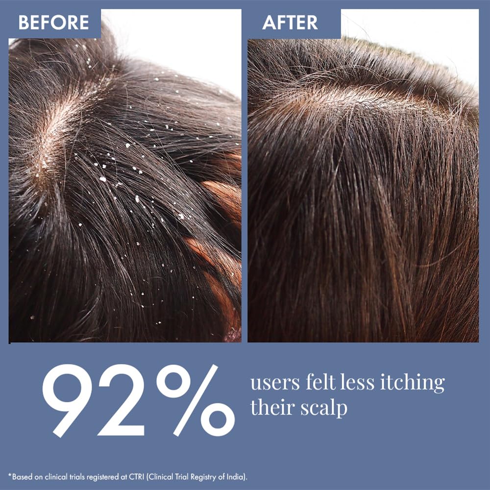 ThriveCo Anti Dandruff Scalp Clear Shampoo | Removes Dandruff From Source | Helps With flaky, Itching, Irritation & Redness Accompanying Dandruff | 100% Effective with First Use | With clinically proven Zenscalpin™, Octopirox, Salicylic Acid Formulation |