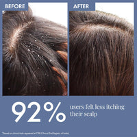 ThriveCo Anti Dandruff Scalp Clear Shampoo | Removes Dandruff From Source | Helps With flaky, Itching, Irritation & Redness Accompanying Dandruff | 100% Effective with First Use | With clinically proven Zenscalpin™, Octopirox, Salicylic Acid Formulation |