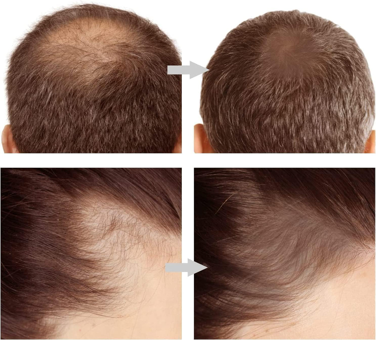 FIGMENT Natural Hairline Powder, Hair Shading Sponge Pen, Hairline Shadow Powder Stick, Quick Hair Root Touch-Up, Paired With 2 Pairs Of Eyebrow Stamp