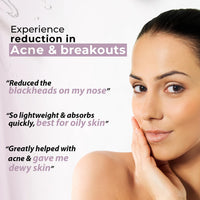 Kaya Acne Care Purifying Nourisher, Gentle/light/non-greasy daily Moisturizer for oily & pimple prone skin, 50 ml