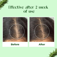 Passion Indulge's Rosemary Hair Growth Kit by Passion Indulge - Rosemary Hair Growth Hair Oil, Serum & Anti Hair Fall Conditioning Shampoo