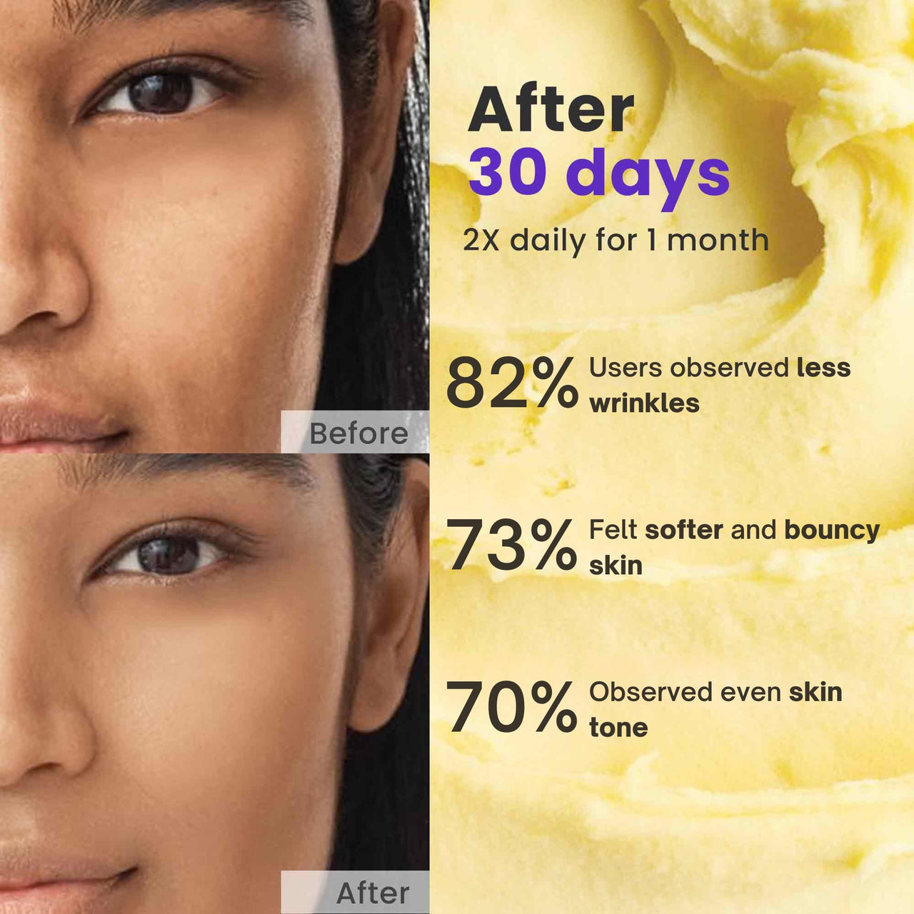 SAFFR'N Anti Ageing Cream With 5% Resveratrol,5% Argireline,10% Hyaluronic Acid,Collagen,Vitamin E,Bakuchiol,Saffron,Centella&Olive Stem Cell Extracts,&Nano Tech To Reduce Ageing Signs|50 Ml