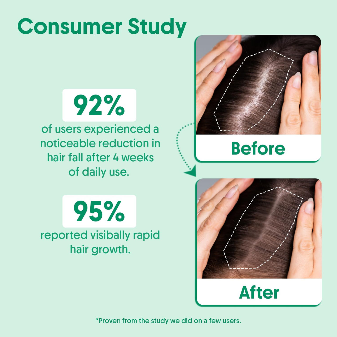 Aravi Organic Rosemary & Biotin Hair Growth Serum - For Hair Growth, Strengthens Hair, and Nourishes Scalp - 30 ml