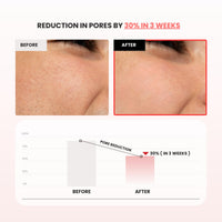Mirabelle Korea Hong Ssal Red Rice Refresh Water Toner 150 ml | Tightens Pores & Moisturize | Women & Men | Korean Skincare