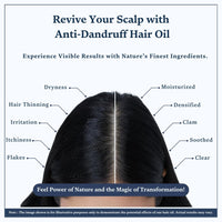 Singular Anti Dandruff Hair Oil for Nourishes & Hydrates Scalp Dandruff-Free Hair | Pure & Natural Cold Pressed Oil Infused with Nature's Best Tea Tree, Coconut, Peppermint, Neem, Rosemary, Argan Oil with Vitamin E | Ideal for Dandruff-Prone Scalp | 400 m