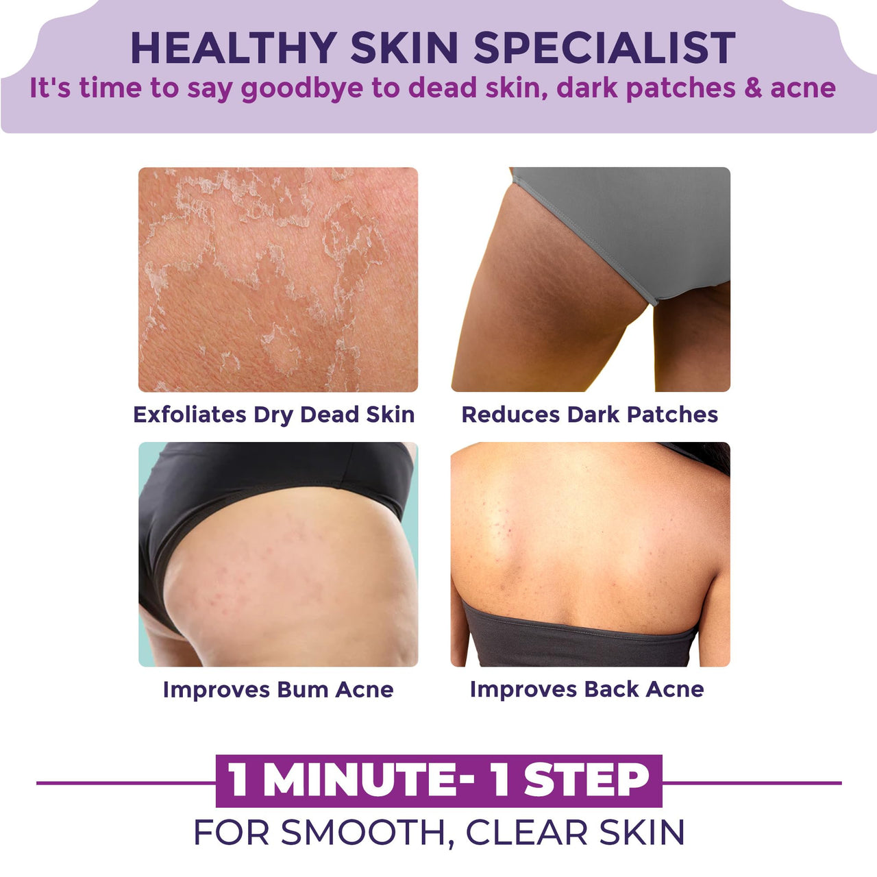 Sanfe Back & Bum Cream for Dark Spots and Body Acne | Glycolic Acid, Lactic Acid & Urea | 11% AHA & Maximum Exfoliation | Remove Dead Skin for Women | 100gm