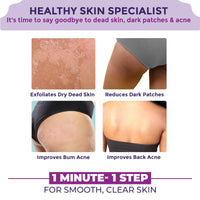 Sanfe Back & Bum Cream for Dark Spots and Body Acne | Glycolic Acid, Lactic Acid & Urea | 11% AHA & Maximum Exfoliation | Remove Dead Skin for Women | 100gm