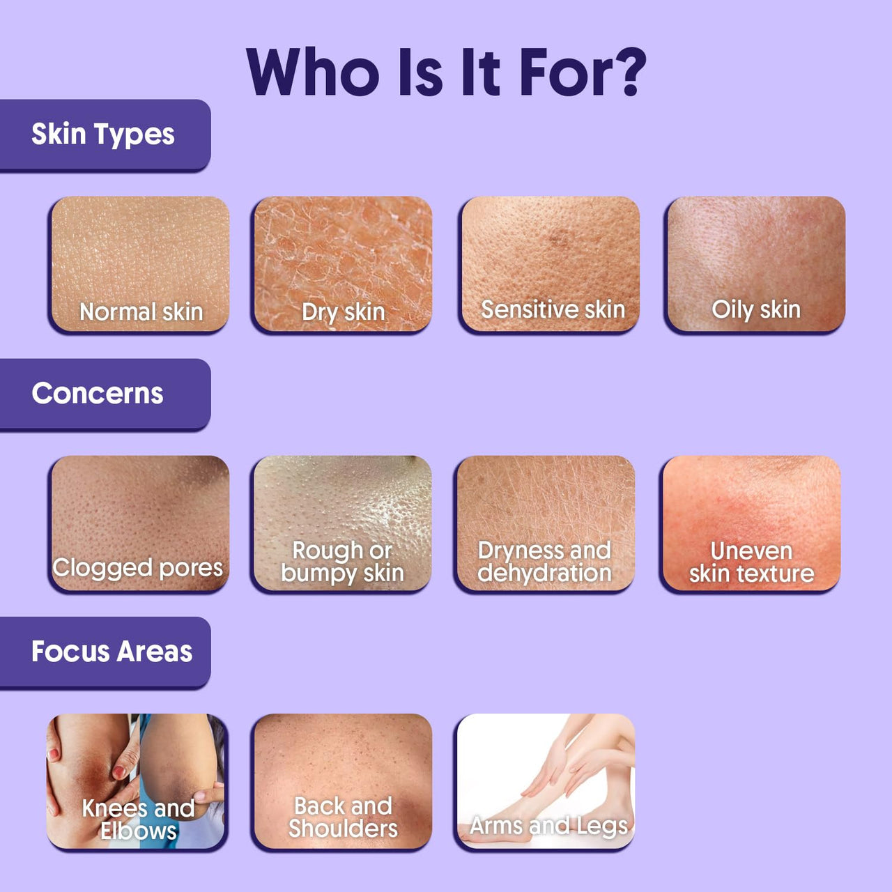 Aravi Organic 10% AHA + 1% BHA Body Lotion For Exfoliation - Treats Strawberry Legs & Bumpy Skin With Ceramide - Skin Britheninig Lotion With Niacinamide and Shea Butter - 200 ml